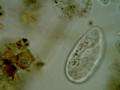 File:Paramecium putrinum.ogv