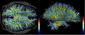 The structure of the white matter of the human brain.