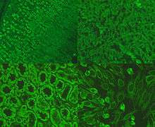 Picture of immunofluorescence staining pattern of AMA antibodies.