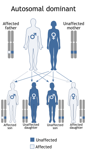 A diagram of the autosomal dominant inheritance pattern, showing how a gene can be passed from an affected parent to an affected child.