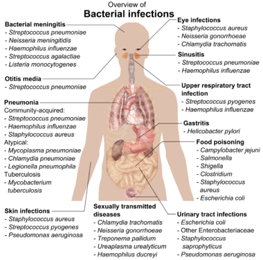 chart showing bacterial infections upon various parts of human body