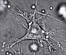 One dendritic cell, which is almost the shape of a star. Its edges are ragged.