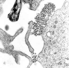 Transmission electron micrograph showing dengue virus