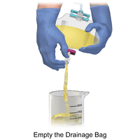 How to empty the urinary drainage bag Illustration.
