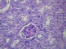 Photomicrograph of kidney section with cells stained in purple.