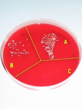 A Petri dish containing a red growth medium, and subdivided into three sectors, labeled A, B and C, respectively. There is much visible microbial growth in culture A, some growth in culture B, and virtually no growth in culture C.