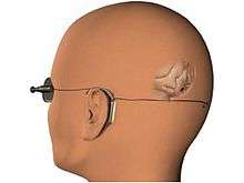 Visual cortical implant designed by Mohamad Sawan