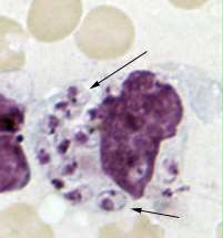 Many small cells of leishmania inside a much larger cell