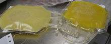 A color photograph of two bags of thawed fresh frozen plasma: The bag on the left was obtained from a donor with hypercholesterolemia, and contains cloudy yellow fluid, while the bag obtained from a normal donor contains clear yellow fluid.