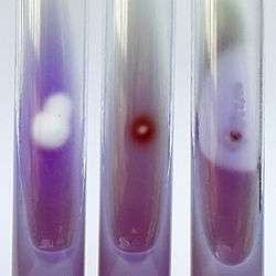 Three tubes of opaque purple growth medium, the left showing a cottony white colony, the middle with a small red and the right with one with a small colony surrounded by a clear halo