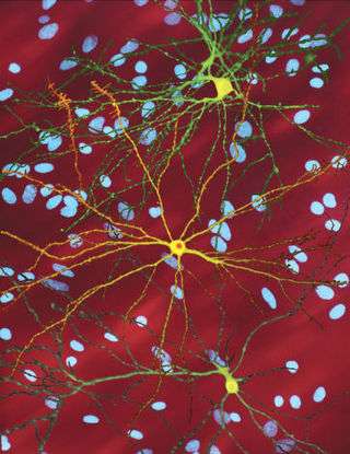Several neurons colored yellow and having a large central core with up to two dozen tendrils branching out of them, the core of the neuron in the foreground contains an orange blob about a quarter of its diameter