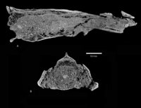 CT X-ray scans of two views of the skull interior.