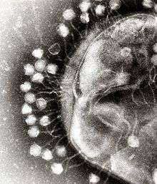 An electron micrograph showing a portion of a bacterium covered with viruses