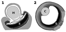 Grayscale diagrams of the structures of the ocelloid and vertebrate eye, showing analogous positional relationships between the hyalosome/lens and retinal body/retina.