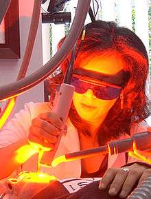 Laser treatment for rosacea using a V-Beam laser