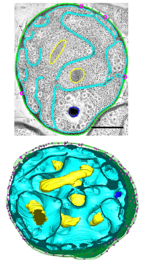 A two-dimensional electron micrograph and three-dimensional tomographic reconstruction of a single G. obscuriglobus cell, with colored highlights to indicate a deeply invaginated membrane within the cell.