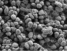 Electron micrograph showing several dozen ellipsoid spores with rough surfaces and a distinct pore in each.