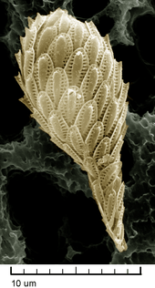 High magnification SEM image of a single Synura cell: It is covered with about 50 delicate, oval scales.