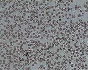 A picture of the blood under a microscope showing thrombocytopenia