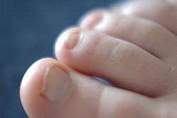 Human toes and nails