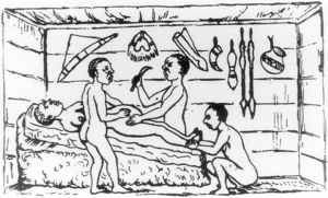 Successful Cesarean section performed by indigenous healers in Kahura, Uganda. As observed by R. W. Felkin in 1879.