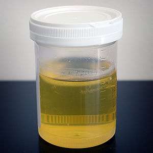 sample of human urine in plastic vessel with white screw-top
