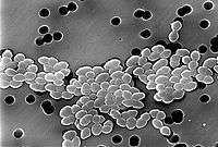 Black and white micrograph: a band of sphere-shaped bacteria, clustered in pairs, extends across a gray field.
